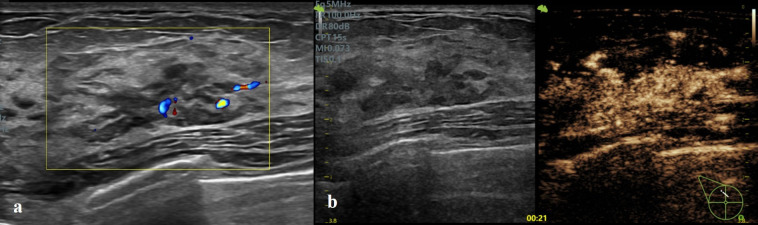 Figure 2