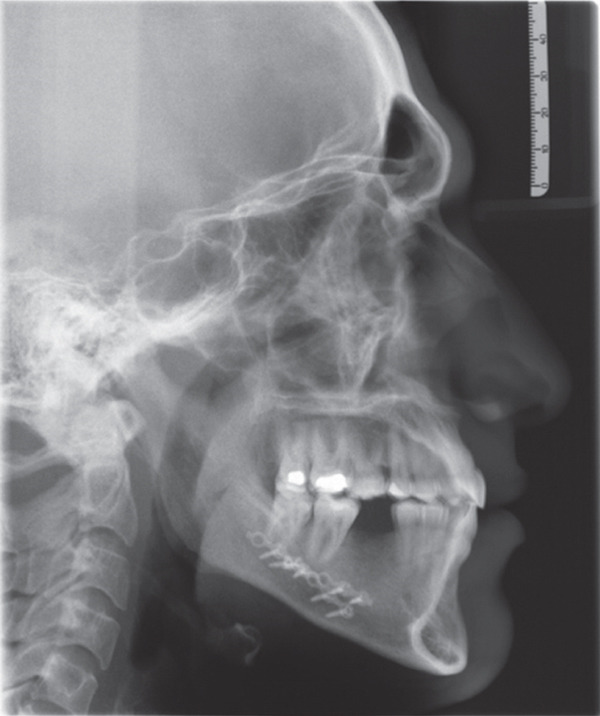 Figure 14
