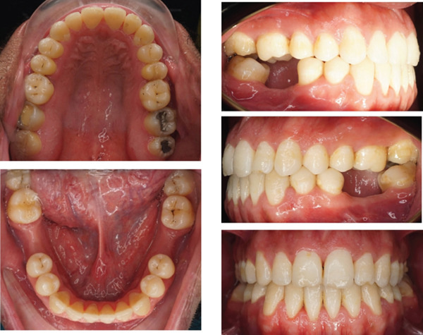 Figure 11