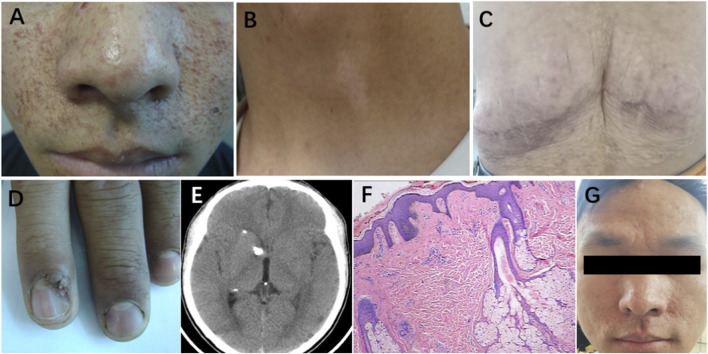 FIGURE 1
