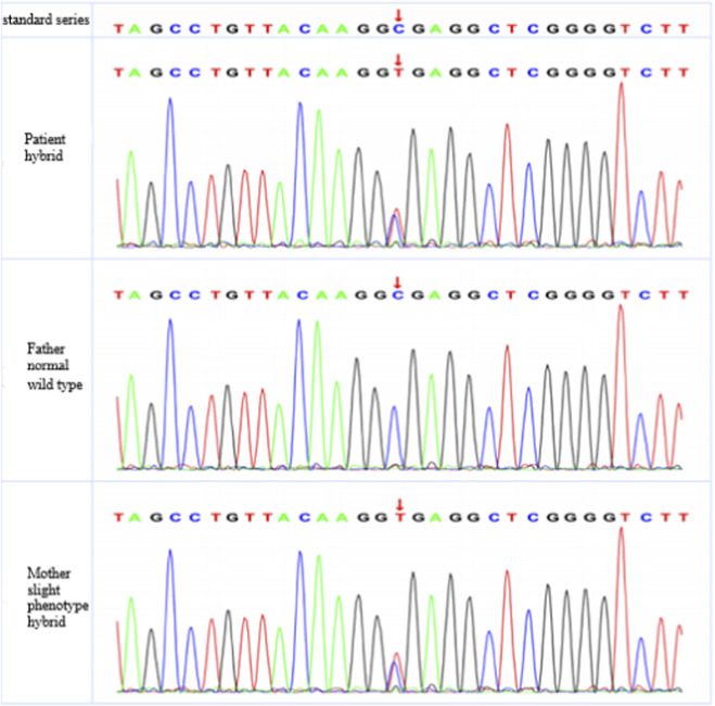 FIGURE 2