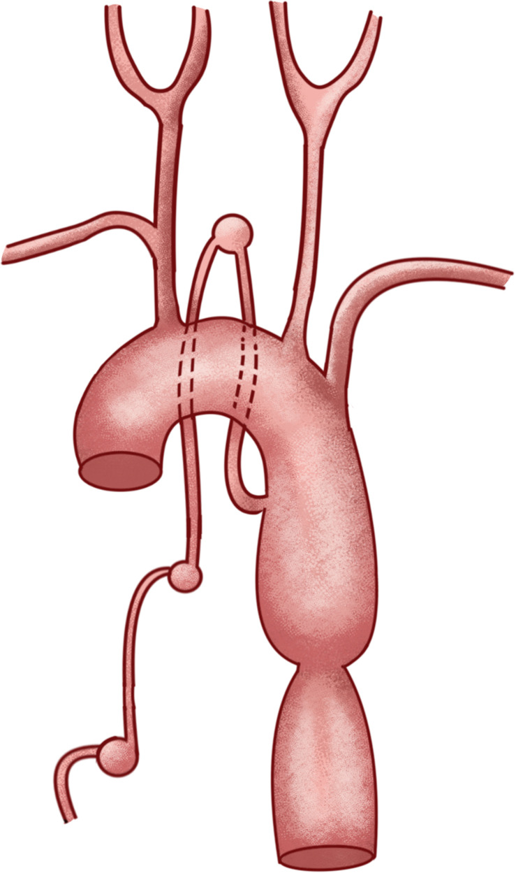 Figure 4