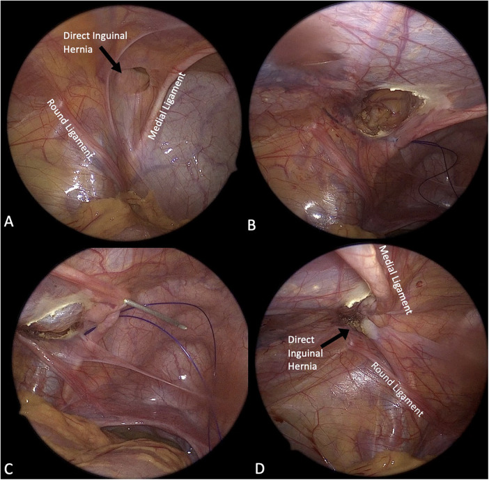 Figure 1