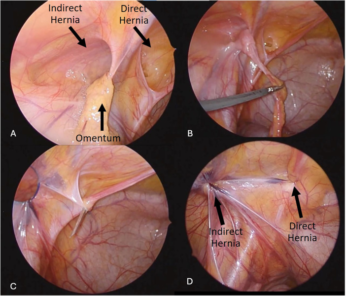Figure 2