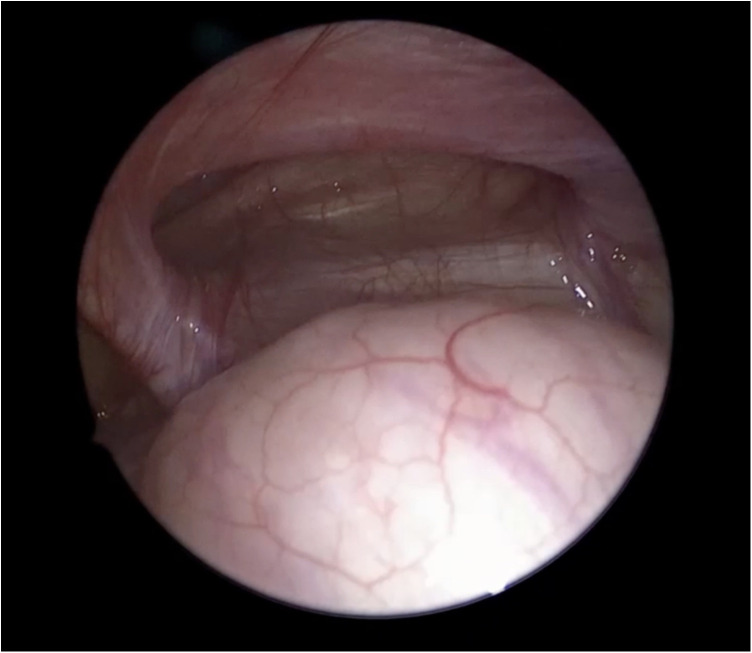 Figure 3