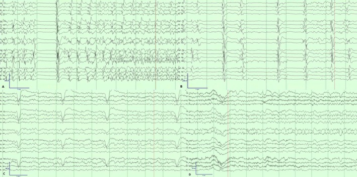 FIGURE 4