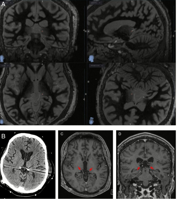 FIGURE 2