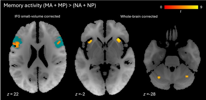 FIGURE 4