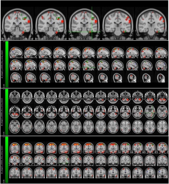 FIGURE 3