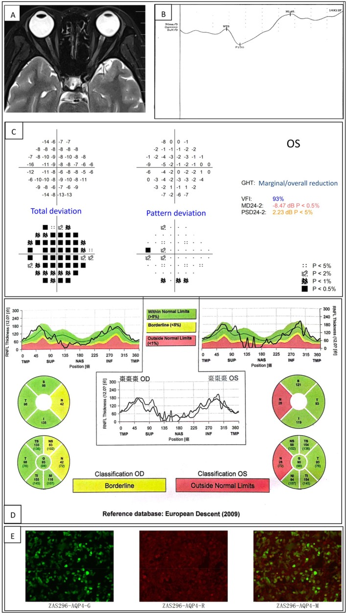 FIGURE 1