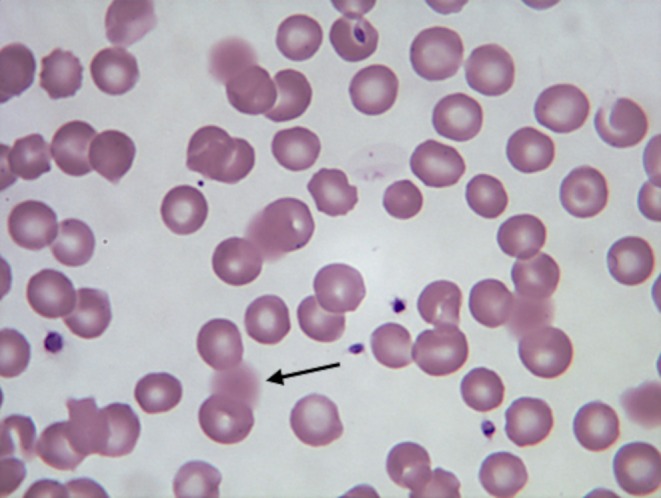 FIG 1