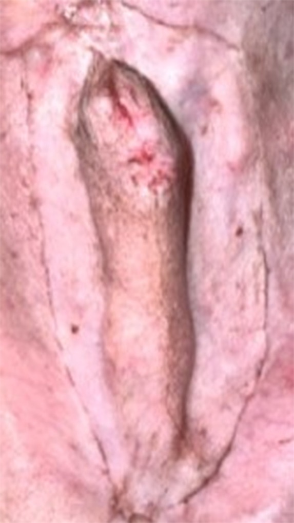 FIG 4