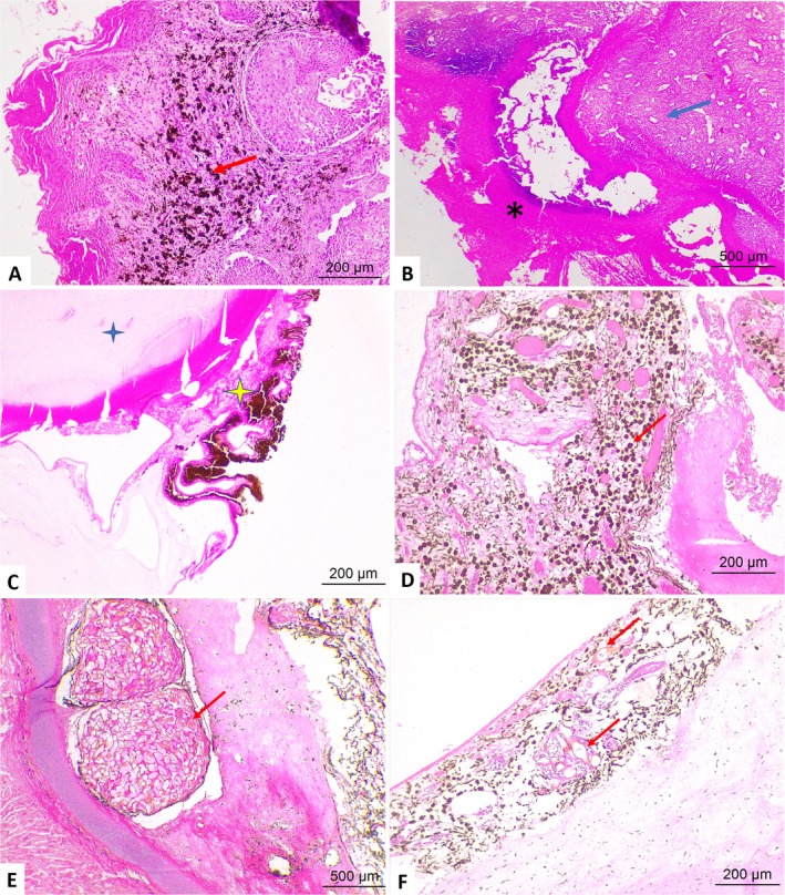 FIGURE 3