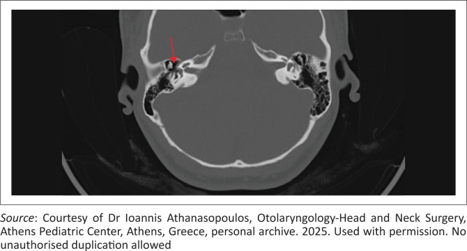 FIGURE 2