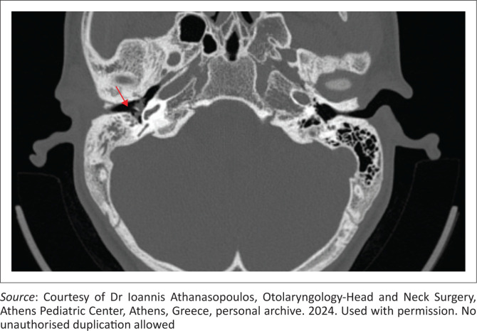 FIGURE 3