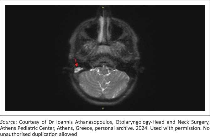 FIGURE 6