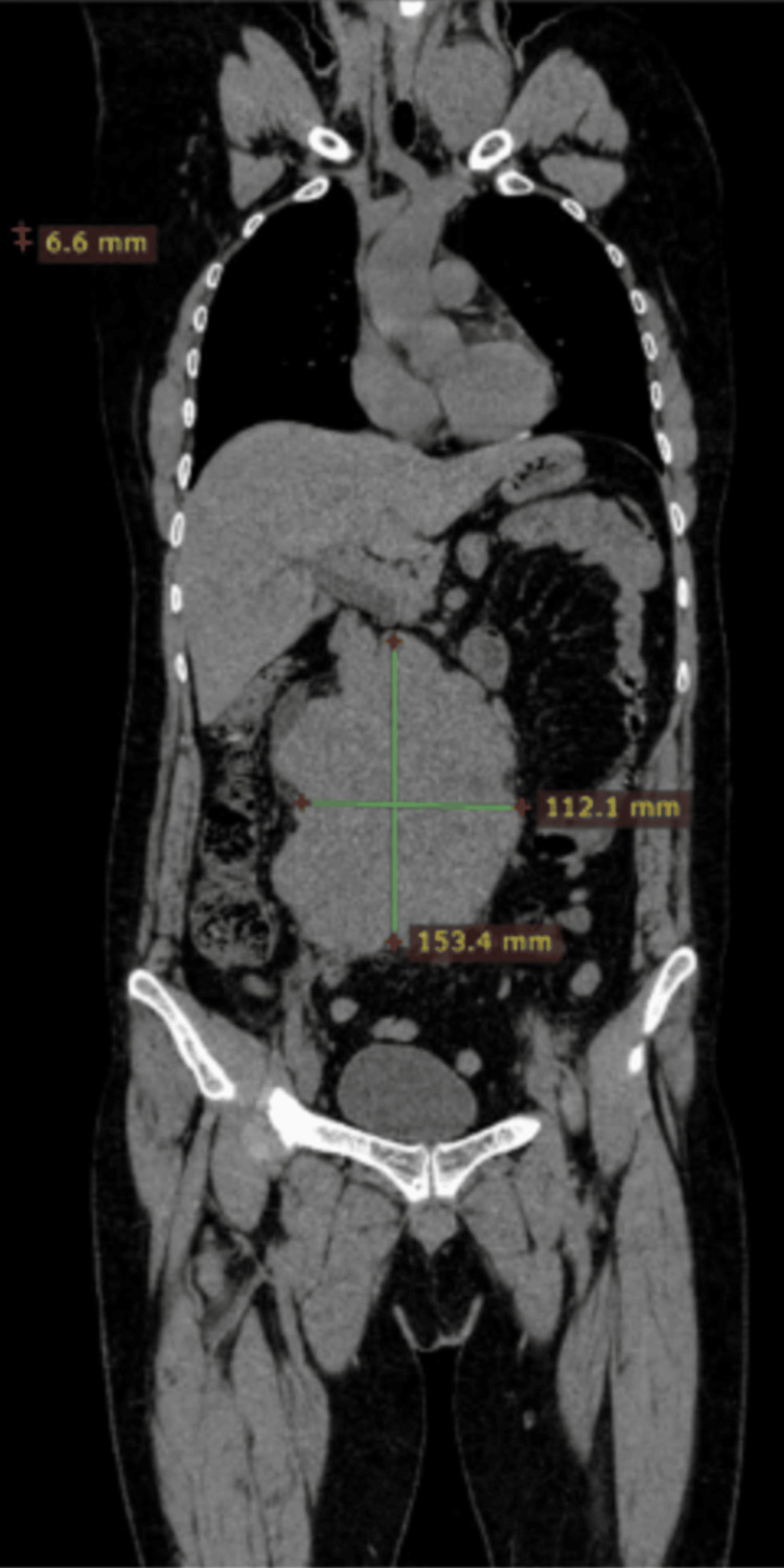 Figure 9