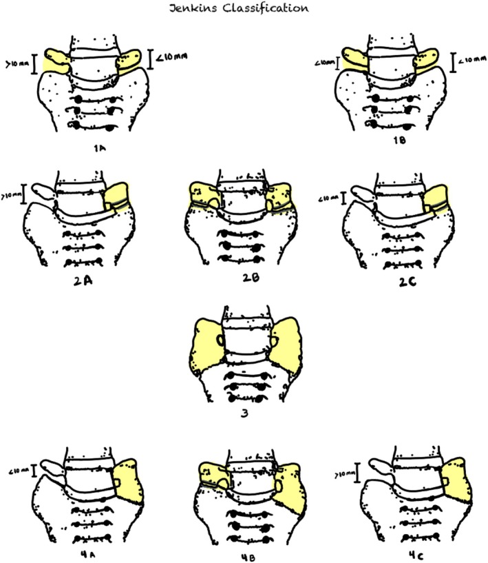 FIGURE 3