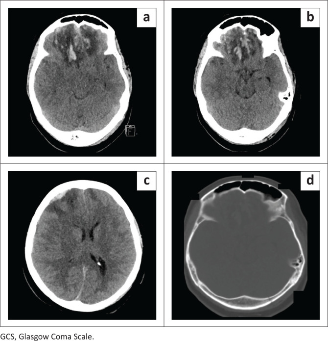 FIGURE 6