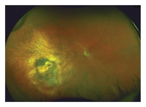 Figure 3