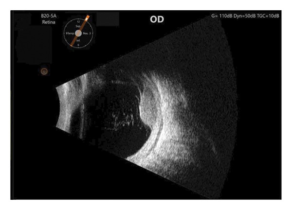 Figure 6