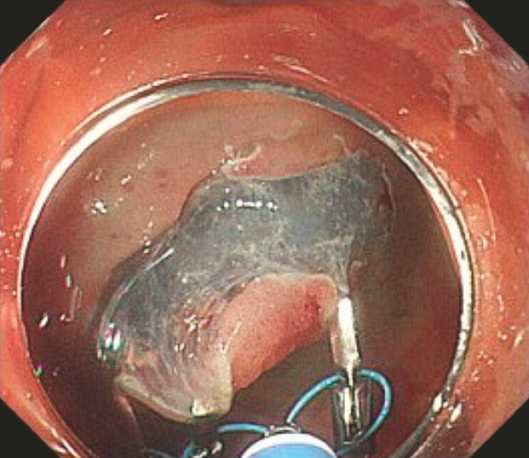 Fig. 2