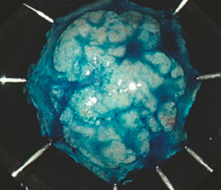 Fig. 3