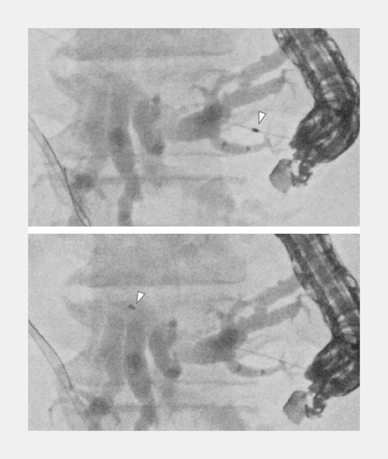 Fig. 4
