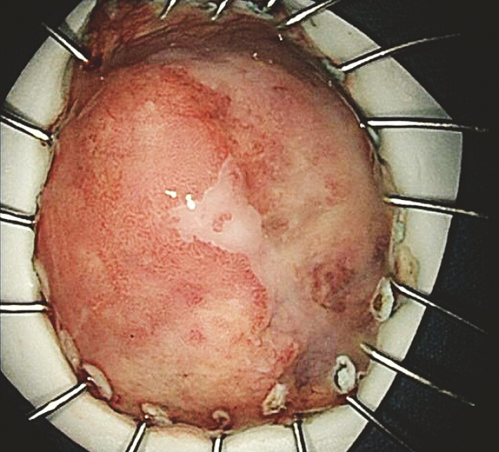 Fig. 3