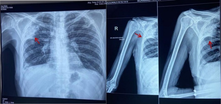 FIGURE 1