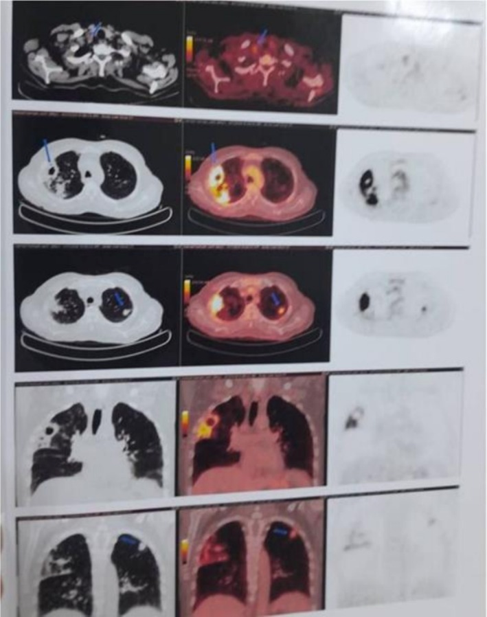 FIGURE 2