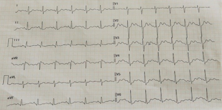 FIGURE 1
