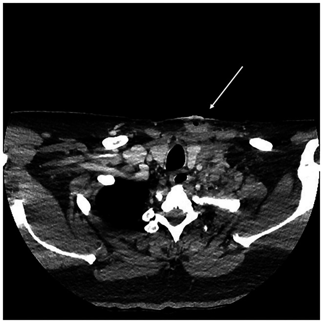 FIGURE 1