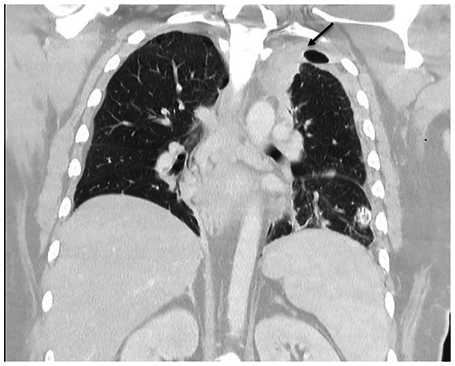 FIGURE 3