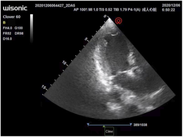 FIGURE 3