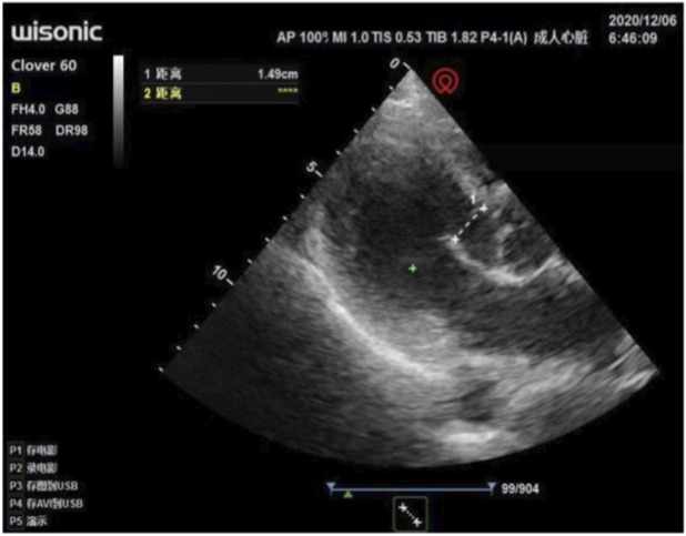 FIGURE 4