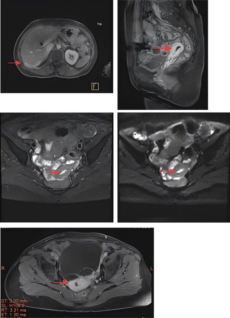 Figure 2