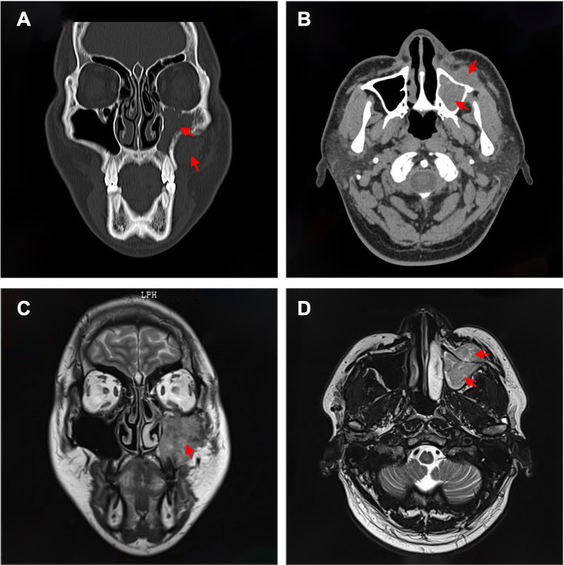Figure 2