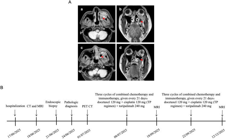 Figure 4