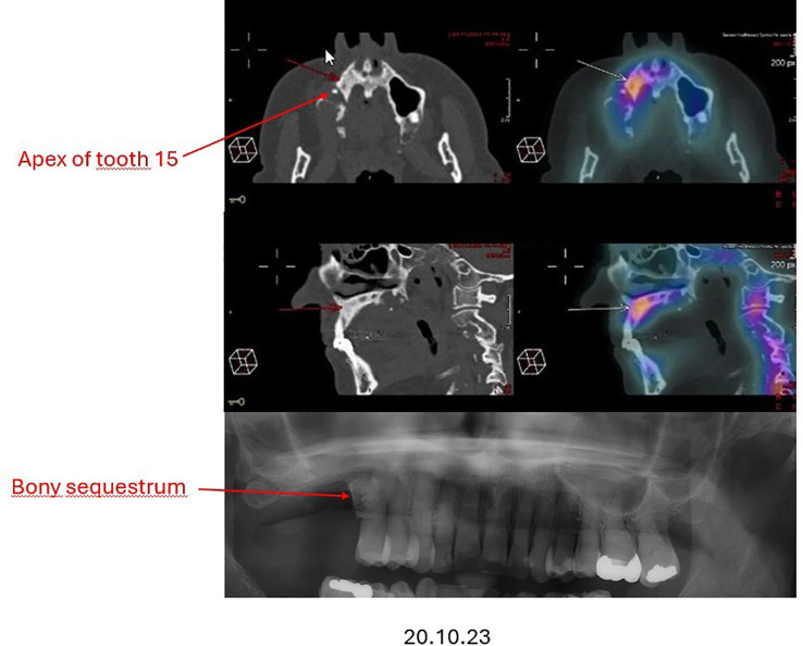 Figure 2
