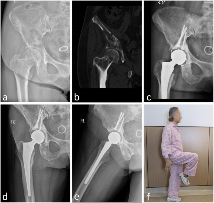 Figure 3