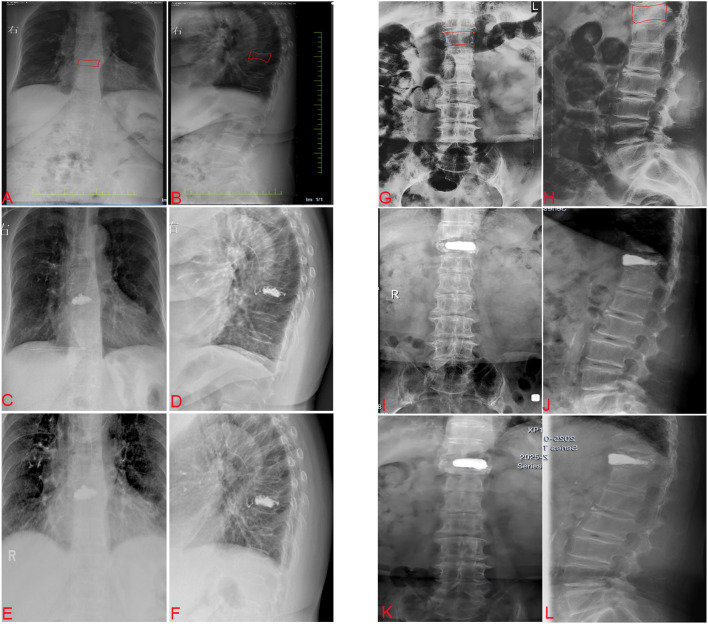 Figure 2