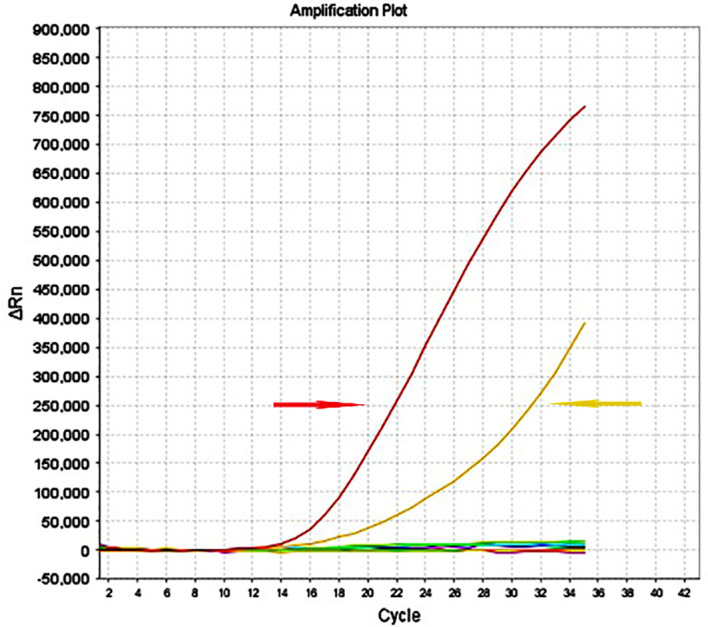 Figure 4