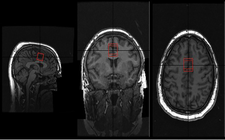 FIGURE 1