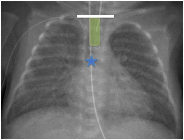 Figure 1