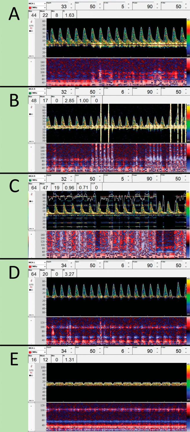 FIGURE 2