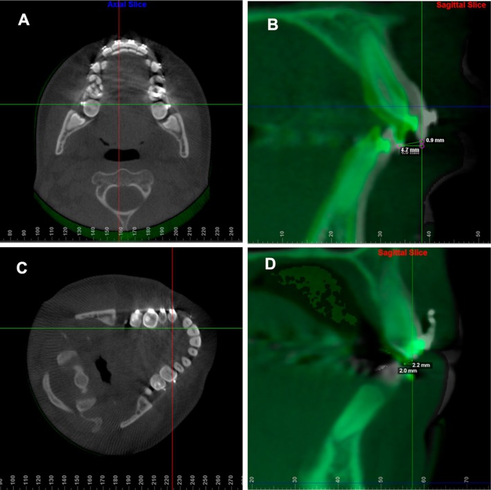 FIGURE 3