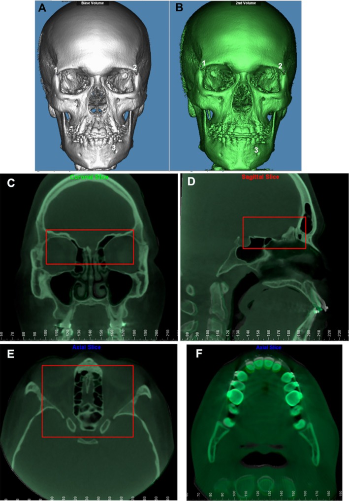 FIGURE 1
