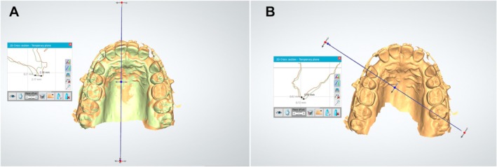 FIGURE 4
