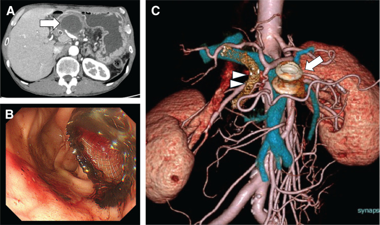 Fig. 2